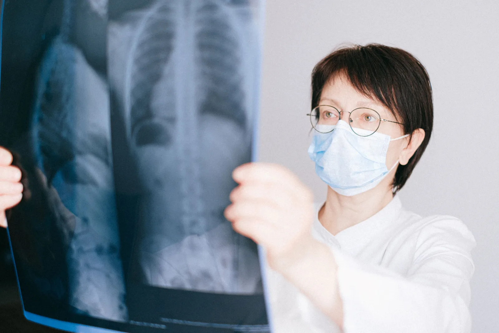 Medical professional examining a chest X-ray